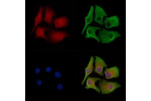 ABIN6258617 and ABIN6274962 staining Hela cells by IF/ICC.