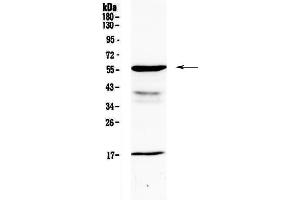 Western blot analysis of GALNS using anti-GALNS antibody . (GALNS antibody  (AA 181-289))