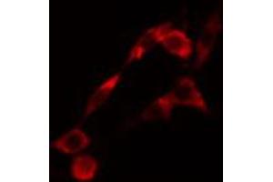 ABIN6274420 staining LOVO cells by IF/ICC. (LMTK2 antibody  (Internal Region))