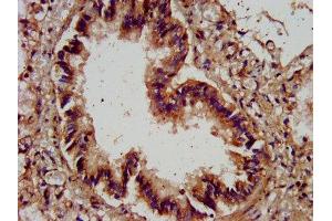 Immunohistochemistry (IHC) image for anti-Agrin (AGRN) (AA 968-1130) antibody (ABIN7143601)