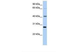 Image no. 1 for anti-RNA Binding Motif Protein 34 (RBM34) (C-Term) antibody (ABIN6739140) (RBM34 antibody  (C-Term))