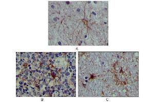 Immunohistochemical analysis of paraffin-embedded human brain tissue (A), lymphoid follicles tissue (B) and interbrain tissue (C), showing cytoplasmic localization using S100A mouse mAb with DAB staining. (S100A1 antibody)