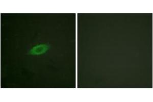 Immunofluorescence analysis of HeLa cells, using Annexin A6 Antibody. (ANXA6 antibody  (AA 1-50))