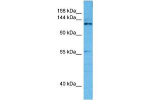 Host:  Mouse  Target Name:  CASZ1  Sample Tissue:  Mouse Pancreas  Antibody Dilution:  1ug/ml (CASZ1 antibody  (Middle Region))