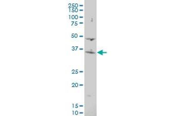 ASMT antibody  (AA 71-170)