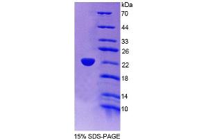 SDS-PAGE (SDS) image for Acyl-CoA Oxidase 3, Pristanoyl (ACOX3) (AA 529-700) protein (His tag) (ABIN4989953)