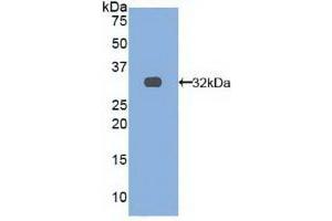 Detection of Recombinant TRAF4, Human using Polyclonal Antibody to TNF Receptor Associated Factor 4 (TRAF4) (TRAF4 antibody  (AA 193-444))