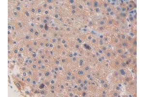 Used in DAB staining on fromalin fixed paraffin- embedded liver tissue (Factor VIII antibody  (AA 2253-2346))