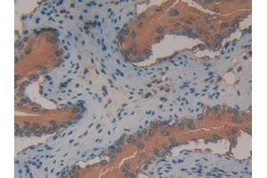 Detection of ANXA2 in Mouse Vas Deferens Tissue using Polyclonal Antibody to Annexin A2 (ANXA2) (Annexin A2 antibody  (AA 1-339))