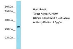 Image no. 1 for anti-R3H Domain Containing 4 (R3HDM4) (AA 45-94) antibody (ABIN6750725) (R3HDM4 antibody  (AA 45-94))
