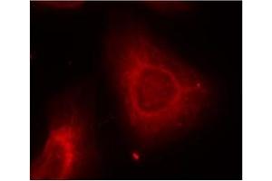 Image no. 2 for anti-Keratin 8 (KRT8) (Ser73) antibody (ABIN197583) (KRT8 antibody  (Ser73))