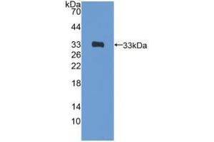 Western blot analysis of recombinant Rat GATA4. (GATA4 antibody  (AA 228-440))