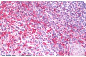 ABIN5539869 (5µg/ml) staining of paraffin embedded Human Spleen.