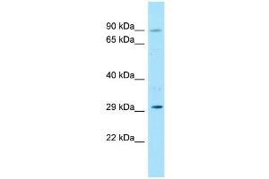 Host:  Rabbit  Target Name:  Foxk1  Sample Type:  Rat Thymus lysates  Antibody Dilution:  1. (Foxk1 antibody  (N-Term))