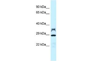 WB Suggested Anti-LOC100362453 Antibody Titration: 1. (LOC100362453 antibody  (C-Term))