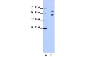 TROVE2 antibody used at 1 ug/ml to detect target protein.