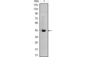 Western blot analysis using CTNNB1 mouse mAb against CTNNB1-hIgGFc transfected HEK293 cell lysate.