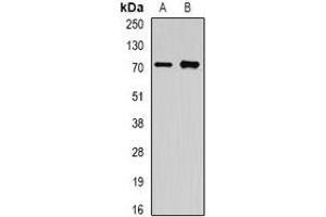 Western blot analysis of OLFM1 expression in A549 (A), mouse brain (B) whole cell lysates. (Olfactomedin 1 antibody)