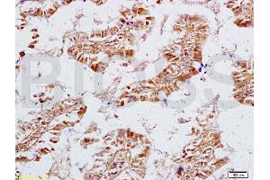 Formalin-fixed and rat intestine tissue labeled with Anti-NPY/Neuropeptide Y Polyclonal Antibody, Unconjugated (ABIN673134) at 1:200 followed by conjugation to the secondary antibody and DAB staining (ECE1 antibody  (AA 665-770))