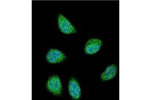 Confocal immunofluorescent analysis of SERPINA6 Antibody (Center) Cat.