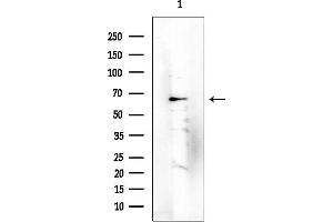 anti-Forkhead Box O4 (FOXO4) (Internal Region) antibody