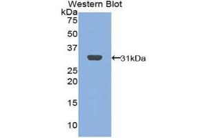 Western Blotting (WB) image for anti-B-Cell Linker (BLNK) (AA 65-314) antibody (ABIN1858143) (B-Cell Linker antibody  (AA 65-314))