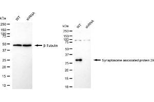 Western blotting analysis using Synaptosome associated protein 29 antibody (ABIN7800488).