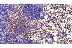 Immunohistochemistry (IHC) image for anti-Chemokine (C-X-C Motif) Receptor 4 (CXCR4) (AA 262-352) antibody (ABIN7432925)