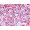 anti-Epidermal Growth Factor Receptor (EGFR) (C-Term) antibody
