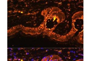 Immunofluorescence analysis of Mouse skin using TYR Polyclonal Antibody at dilution of 1:100. (TYR antibody)