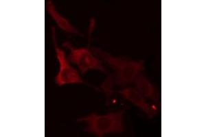ABIN6266943 staining Hela cells by IF/ICC. (ELOVL1 antibody  (Internal Region))