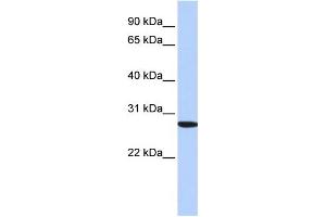 WB Suggested Anti-SP2 Antibody Titration: 0. (Sp2 antibody  (N-Term))