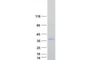 Validation with Western Blot (TGIF1 Protein (Transcript Variant 3) (Myc-DYKDDDDK Tag))