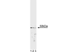 Western Blotting (WB) image for anti-Transcription Factor E3 (TFE3) antibody (ABIN967449) (TFE3 antibody)