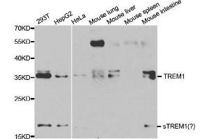Western blot analysis of extracts of various cell lines, using TREM1 antibody. (TREM1 antibody  (AA 21-130))