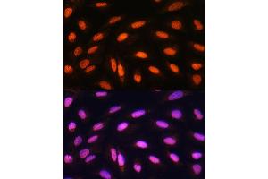 Immunofluorescence analysis of U2OS cells using KB Rabbit pAb (ABIN1680550, ABIN3015032, ABIN3015033, ABIN5663568 and ABIN6213605) at dilution of 1:100. (KAT2B antibody  (AA 583-832))