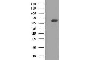 HEK293T cells were transfected with the pCMV6-ENTRY control (Left lane) or pCMV6-ENTRY GBP5 (Right lane) cDNA for 48 hrs and lysed. (GBP5 antibody)