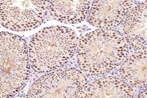 Immunohistochemistry analysis of paraffin-embedded mouse testis using,PARC (ABIN7073606) at dilution of 1: 1200 (CUL9 antibody)
