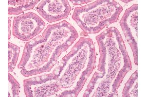 Human Small Intestine: Formalin-Fixed, Paraffin-Embedded (FFPE) (F2RL1 antibody  (C-Term))