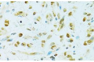 Immunohistochemistry (Paraffin-embedded Sections) (IHC (p)) image for anti-Regulator of Chromosome Condensation 1 (RCC1) antibody (ABIN7262150)