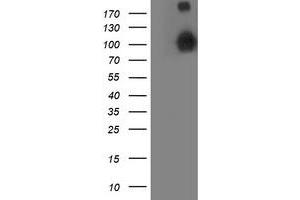 HEK293T cells were transfected with the pCMV6-ENTRY control (Left lane) or pCMV6-ENTRY ANAPC2 (Right lane) cDNA for 48 hrs and lysed. (ANAPC2 antibody)