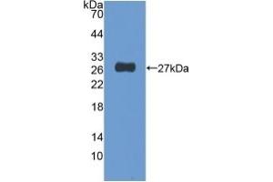 Detection of Recombinant NUP155, Human using Polyclonal Antibody to Nucleoporin 155 (NUP155) (NUP155 antibody  (AA 1154-1379))