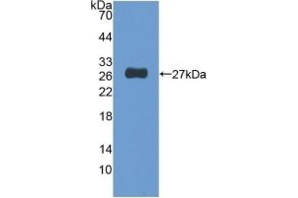 NUP155 抗体  (AA 1154-1379)