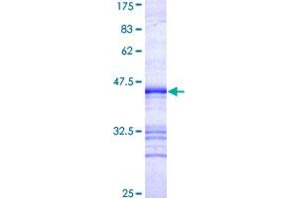 PDCD2L Protein (AA 80-179) (GST tag)
