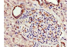 Immunohistochemistry of paraffin-embedded human kidney tissue using ABIN7144836 at dilution of 1:100 (ATP5F1A (AA 59-257) antibody)