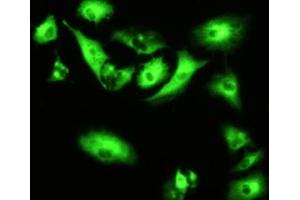 Detection of RNPEP in A549 cells using Polyclonal Antibody to Aminopeptidase B (RNPEP) (RNPEP antibody  (AA 388-616))