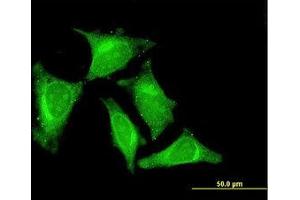 Image no. 3 for anti-RasGEF Domain Family, Member 1C (RASGEF1C) (AA 168-261) antibody (ABIN599341) (RASGEF1C antibody  (AA 168-261))