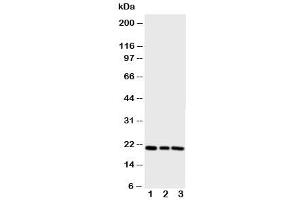 Western blot testing of PBP antibody and Lane 1:  rat brain (PEBP1 antibody  (N-Term))
