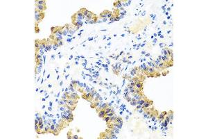 Immunohistochemistry of paraffin-embedded mouse lung using PIP4K2B antibody at dilution of 1:100 (x40 lens). (PIP4K2B antibody)