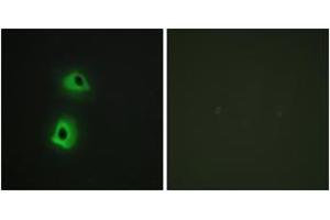 Immunofluorescence analysis of HeLa cells, using T3JAM Antibody. (TRAF3IP3 antibody  (AA 251-300))